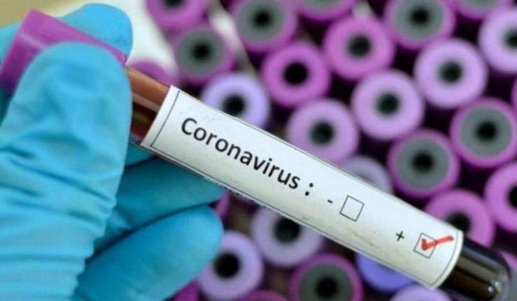Científicos avisan: la vacuna para el coronavirus tardará como mínimo un año, ahora “es urgente la búsqueda de fármacos”