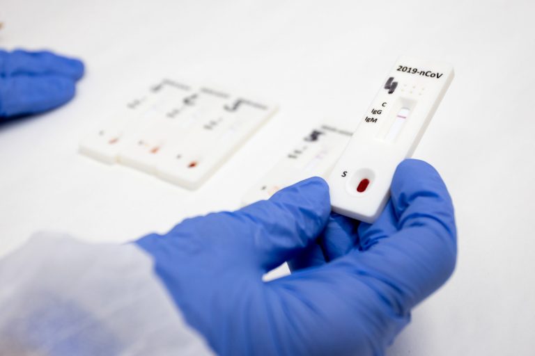 El Gobierno distribuye más de 750.000 test rápidos de anticuerpos entre las CC.AA.