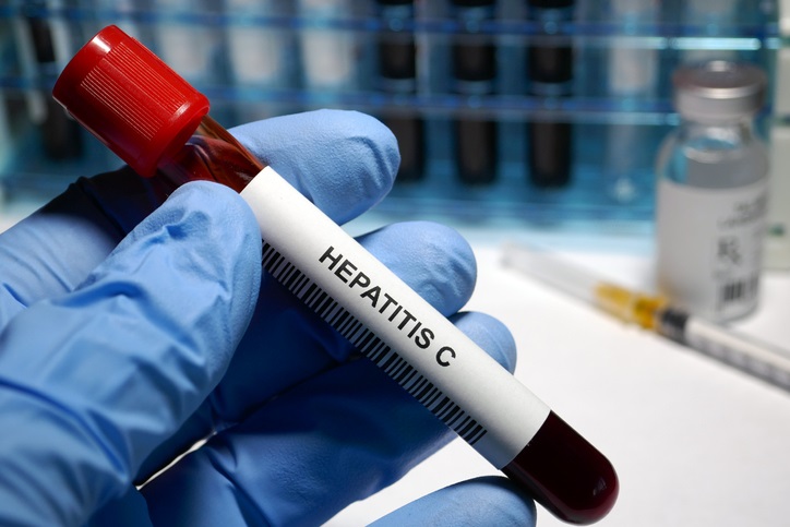 Sanidad publica una guía de cribado de la infección por el virus de la hepatitis C