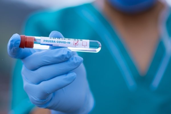 España ha realizado más de 43,5 millones de pruebas diagnósticas desde el inicio de la epidemia