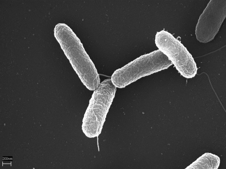 La notificación de toxoinfecciones alimentarias bajó a la mitad en 2020, «ayudada» por las medidas antiCovid