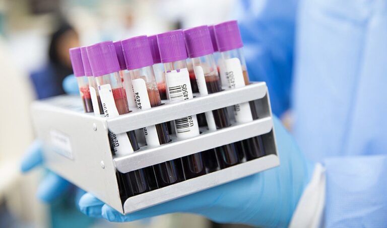 Consello.- ‘Xenoma Galicia’ detecta 14 nuevos casos de alto riesgo entre los más de 1.000 participantes en el proyecto