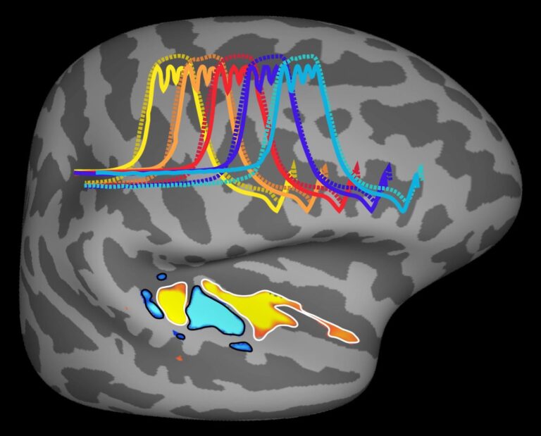 Una investigación gallega revela que la música cambia la microbiota en personas con autismo y demencia